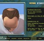 Hair Loss 3d demo
